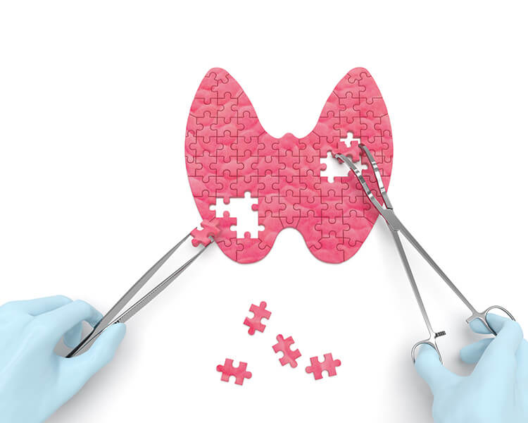  Let us solve the puzzle of your thyroid concerns.